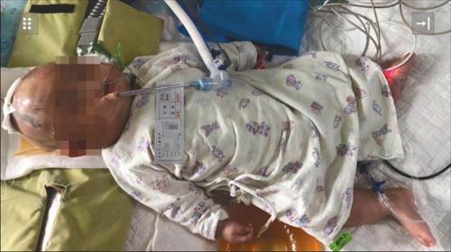 DNA identifies girl who dropped apple from balcony, putting baby in coma