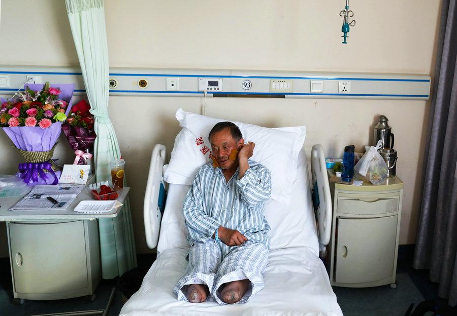 Xia receives treatment in a hospital for his frostbitten face and fingers. (Photo/China Daily)
In 2014 and 2015, respectively, he was at the base camp of the south slope of Qomolangma in Nepal, but could not proceed due to an avalanche and an earthquake.
Later, in 2016, Xia tried to climb the mountain for the fourth time. But when he was less than 100 meters from the summit, a snowstorm blocked his way.