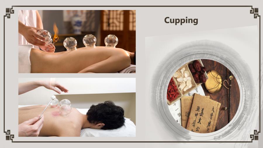Cupping involves putting heated cups against the skin that create a small area of mild suction. It is believed by some that cupping promotes blood circulation and can relieve pain. (Photo/China Plus)