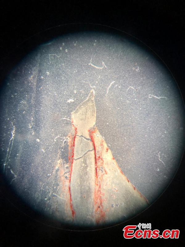 A tooth image of the thin section of Changchunsaurusparvus under a microscope. (Photo: China News Service/Zhang Yao)