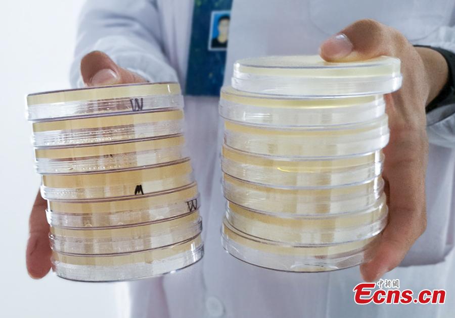 Patterns formed with bacteria are shown in petri dishes during a microbial art competition at China Pharmaceutical University in Nanjing, East China’s Jiangsu province. Students of the school have created artworks by placing various strains of bacteria like staphylococcus and colibacillus into petri dishes, and letting the microbes react and spread across carefully drawn patterns. (Photo: China News Service/ Jiang Chen)