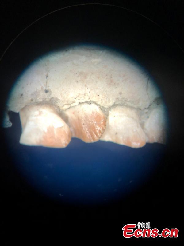 A tooth image of the thin section of Changchunsaurusparvus under a microscope. (Photo: China News Service/Zhang Yao)