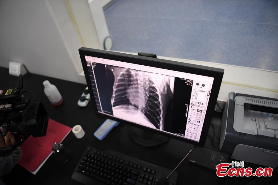 Giant panda Xiaohetao has a health check at the Shenshuping base of the China Conservation and Research Center for the Giant Panda in Sichuan Province, Dec. 26, 2018 before its release into the wild. Medical work on the two young pandas included blood tests and check for parasites as well as X-rays. Qinxin was found to weigh 64 kilograms and 117 centimeters tall while Xiaohetao tipped the scales at 62 kilograms and measured 99 centimeters in height. Both are in good health, according to researchers, and will wear GPS collars to track their movements and collect data. The two panda cubs underwent training for reintroduction into the wild. (Photo: China News Service/Li Chuanyou)