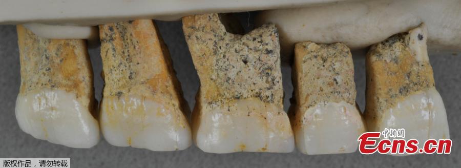 From right to left, two premolars and three molars from the upper right jaw of the same Homo Luzonensis adult.  (Photo/Agencies)