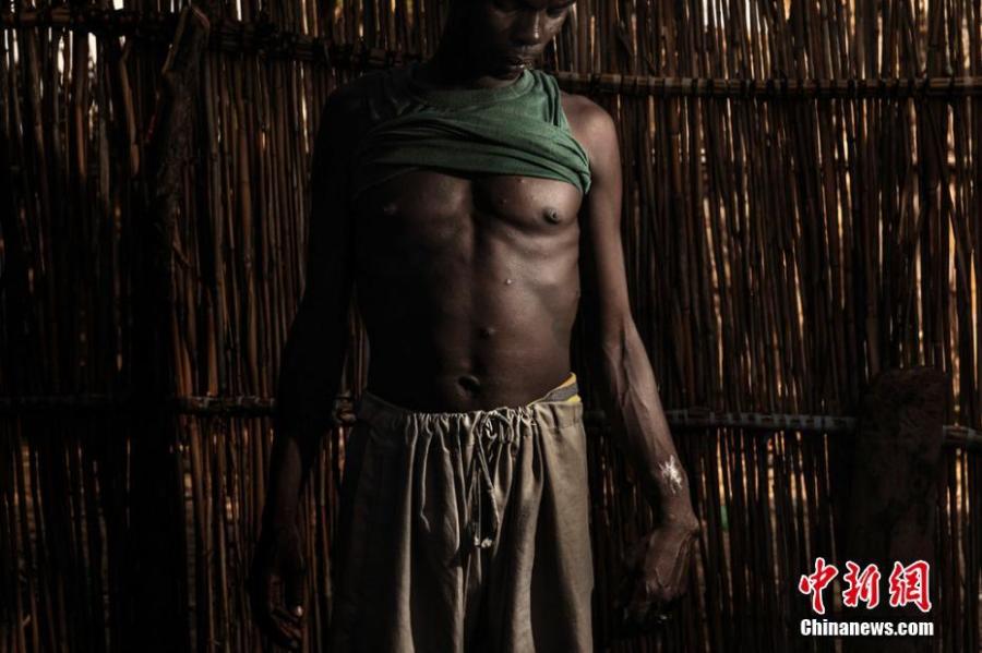 Environment, stories winner

Ababakar Mbomi, an anti-Jihad activist in Melea, Chad, was shot 11 times when Boko Haram kidnapped his wife in 2014.

Photographer: Marco Gualazzini/Contrasto
