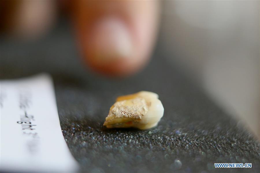 A molar tooth is seen as part of the set of fossils of a newly discovered human species called Homo luzonensis at the University of the Philippines in Quezon City, the Philippines, April 11, 2019. Found in Callao Cave on Luzon Island, the 50,000-year-old remains belong to a now extinct species of human. (Xinhua/Rouelle Umali)