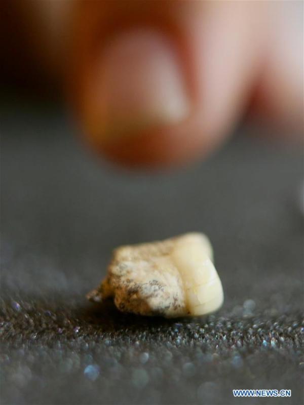 A premolar tooth is seen as part of the set of fossils of a newly discovered human species called Homo luzonensis at the University of the Philippines in Quezon City, the Philippines, April 11, 2019. Found in Callao Cave on Luzon Island, the 50,000-year-old remains belong to a now extinct species of human. (Xinhua/Rouelle Umali)