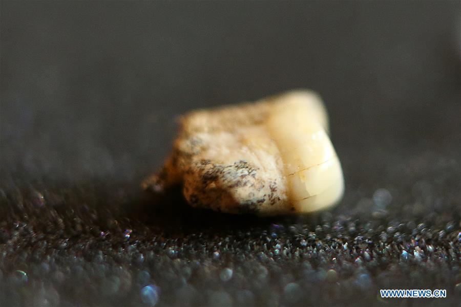 A premolar tooth is seen as part of the set of fossils of a newly discovered human species called Homo luzonensis at the University of the Philippines in Quezon City, the Philippines, April 11, 2019. Found in Callao Cave on Luzon Island, the 50,000-year-old remains belong to a now extinct species of human. (Xinhua/Rouelle Umali)