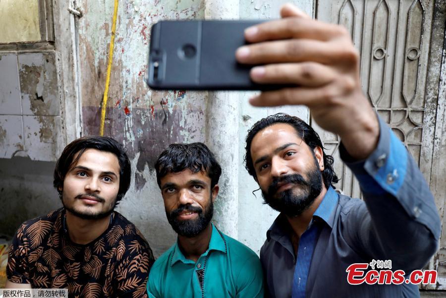 People take selfie with Rozi Khan, 26, a waiter and a lookalike of Hollywood\'s actor Peter Dinklage, who plays a character of Tyrion Lannister in the tv series \