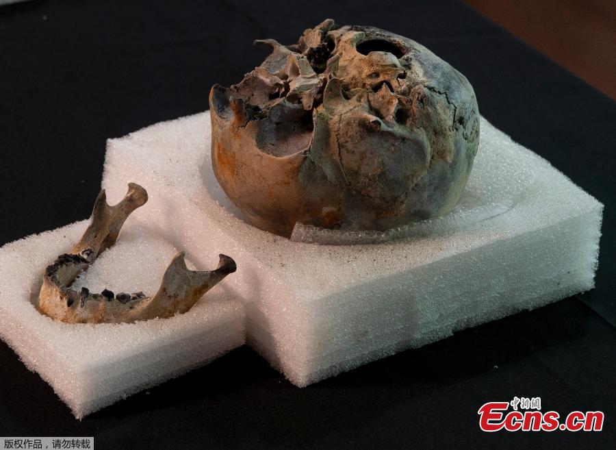 A mummy skull that was used for research purposes is presented to the media by the National Museum during a news conference in Rio de Janeiro, Brazil, Tuesday, May 7, 2019. Brazil\'s national museum said Tuesday it has recovered 200 pieces from its 700 pieces Egypt collection, the largest in Latin America, after a devastating fire in September 2018.