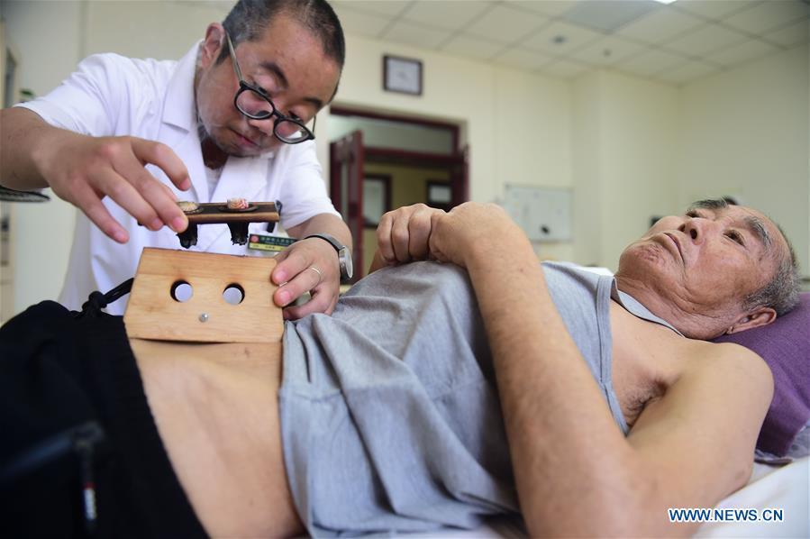 A doctor gives moxibustion treatment to a patient at Cangzhou People\'s Hospital in Cangzhou, north China\'s Hebei Province, May 26, 2019. Traditional medicine originating from Traditional Chinese Medicine (TCM) has been incorporated into the 11th revision of the International Classification of Diseases (ICD), marking a major step for TCM\'s internationalization. The revision was approved Saturday at the 72 World Health Assembly being held in Geneva, Switzerland, according to China\'s National Administration of Traditional Chinese Medicine. (Xinhua/Fu Xinchun)
